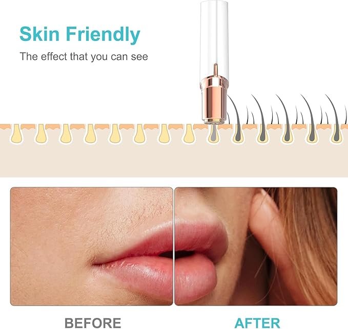 Flawless Facial Hair Remover Machine For Men & Women – Face, Chin, Cheek, Eyebrow, Upper Lip Hair Remover, USB RECHARGEABLE Epilator Machine for Women (Facial Shaper Epilator)