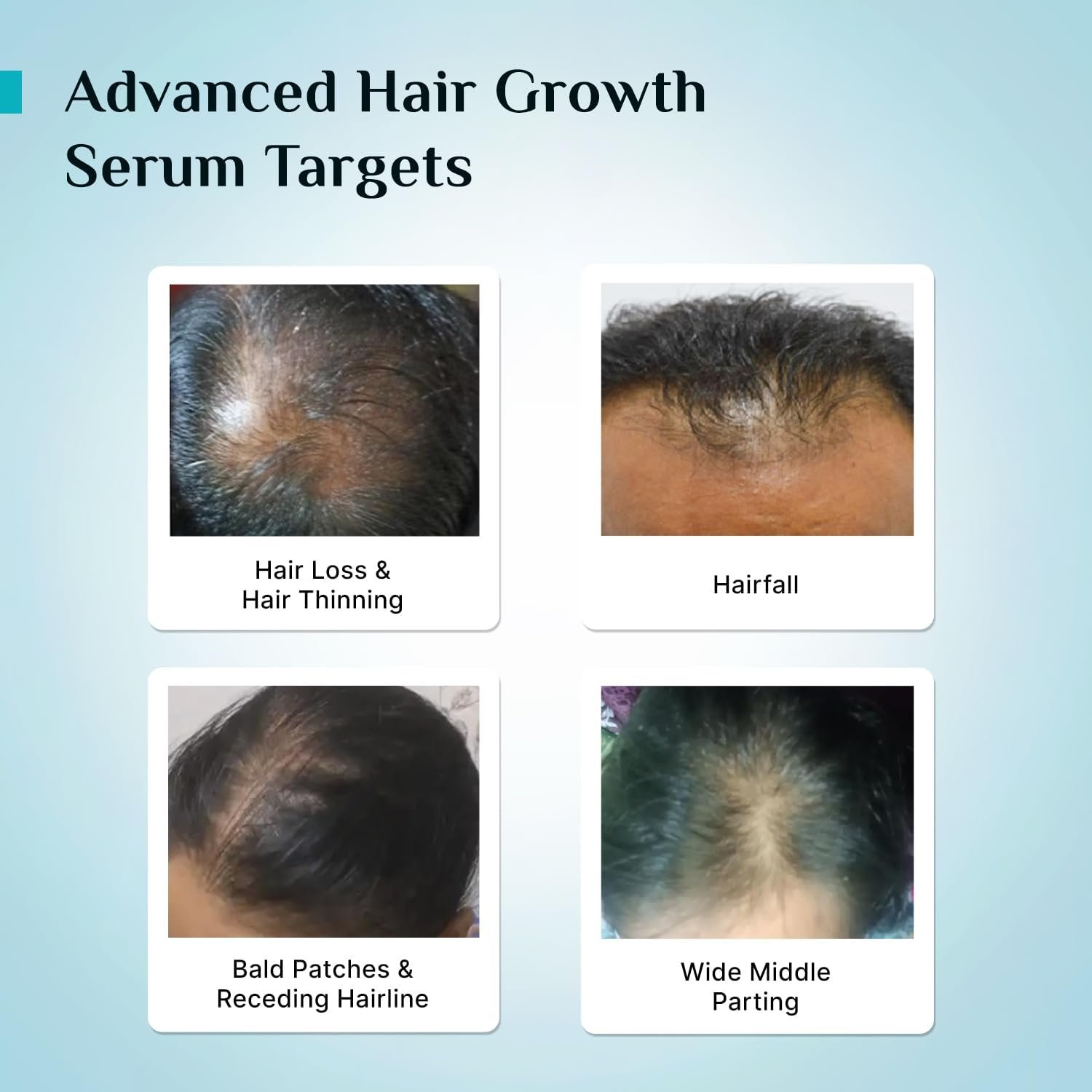 Pilgrim Advanced Hair Growth Serum with 3% Redensyl & 4% AnaGain -30ml - Image 5