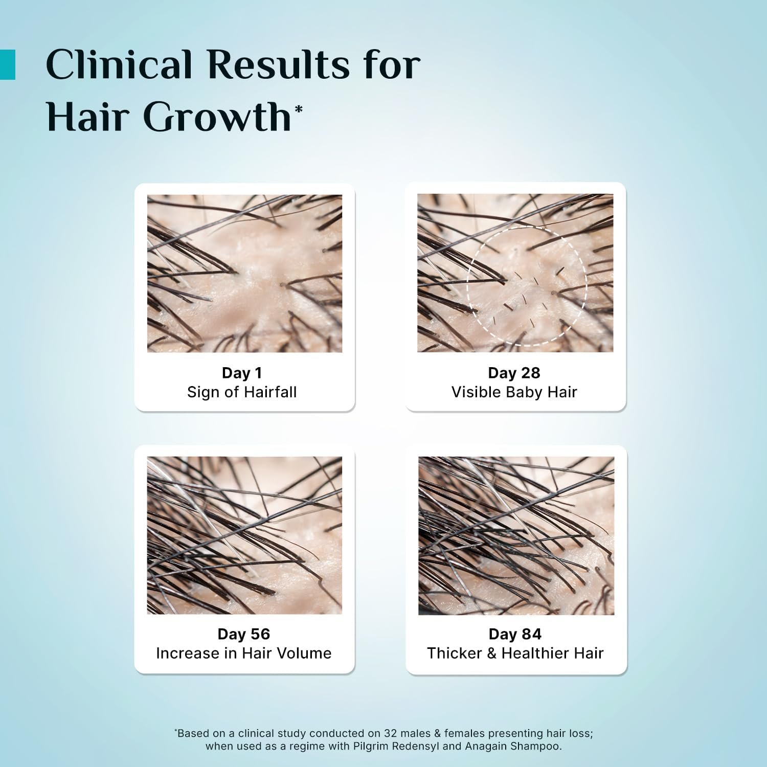Pilgrim Advanced Hair Growth Serum with 3% Redensyl & 4% AnaGain -30ml - Image 6