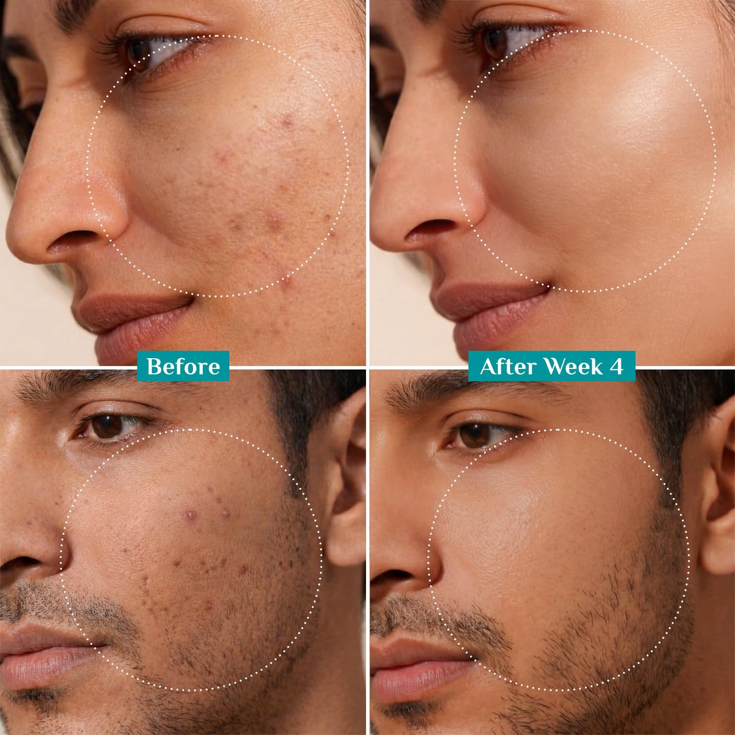 Pilgrim 10% Niacinamide Face Serum for Acne Marks & Glass Skin Glow - 30ml - Image 7