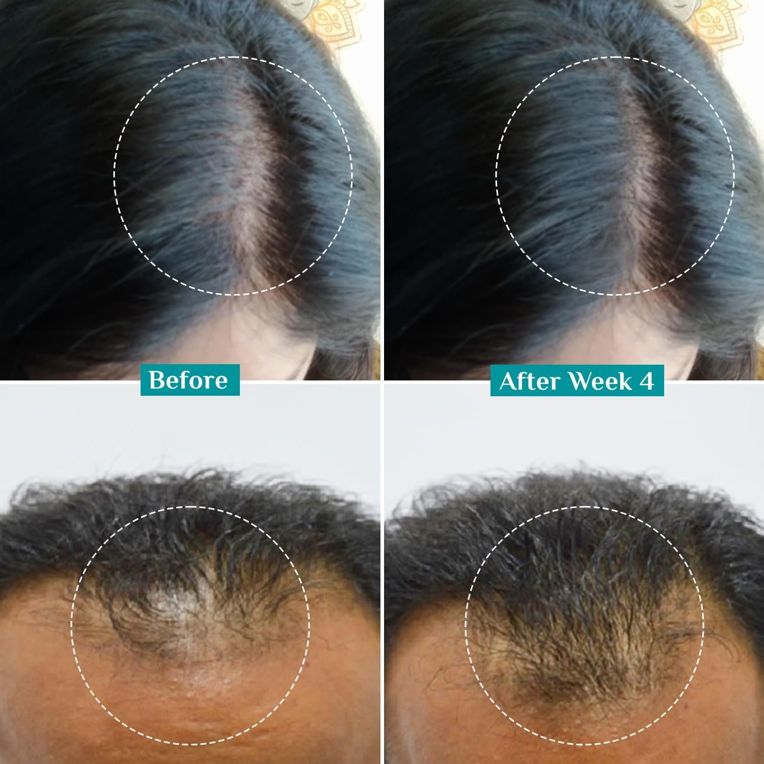 Pilgrim Advanced Hair Growth Serum with 3% Redensyl & 4% AnaGain -30ml - Image 3